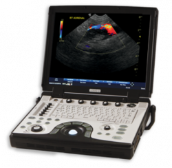 УЗИ аппарат Logiq E - Фото 1