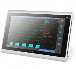 Монитор пациента ЮМ 300-20 - Фото 1