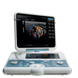 УЗИ аппарат MyLab Gamma - Фото 1