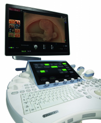 УЗИ аппарат VOLUSON E10 - Фото 1