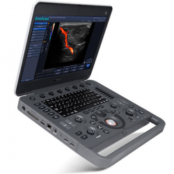 Ультразвуковой сканер X5 - Фото 1