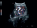 УЗИ аппарат MyLab Gamma - Фото 2