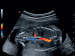 УЗИ аппарат MyLab Gamma - Фото 3