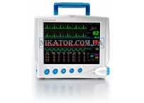 Прикроватный монитор пациента 8000