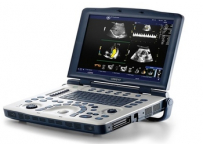 УЗИ аппарат LOGIQ V2