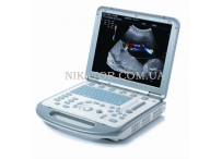 Портативный УЗИ высокого класса M5 Mindray