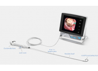 Видеобронхоскоп одноразовый