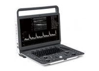 Aппарат УЗИ SonoScape E1