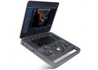 Ультразвуковой сканер X5